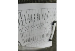 Moteur essuie glace avant SKODA ROOMSTER Photo n°6