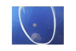 Capot CITROEN C3 1 Photo n°6